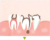 �S�[���h�N���E��1