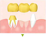 �S�[���h�N���E���Q