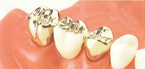 �S�[���h�N���E���R