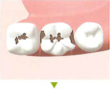 �S�[���h�C�����[�P