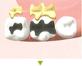 �S�[���h�C�����[�Q