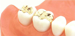 �S�[���h�C�����[�R